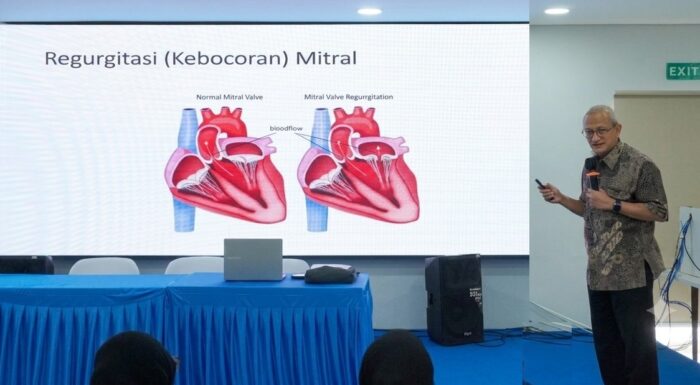 Primaya Hospital Kelapa Gading Hadirkan MitraClip, Harapan Baru bagi Pasien Kebocoran Katup Jantung